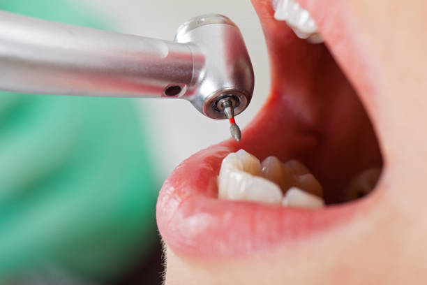 Best Emergency Treatment for Jaw Pain or Injury in Verde Village, AZ